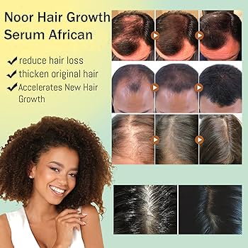 Noor Hair Serum Reviews